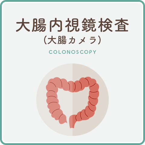 大腸内視鏡検査（大腸カメラ）